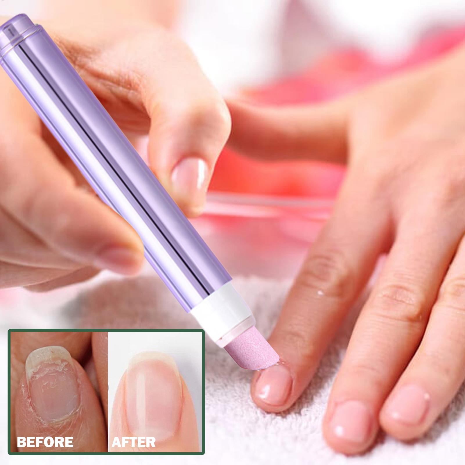 セラミックチップ付き2in1ネイルケアペン、飛び爪、乾燥・傷 - Cuticle Oil Pen のレビューと価格